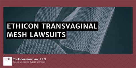 Ethicon Transvaginal Mesh Lawsuit Update
