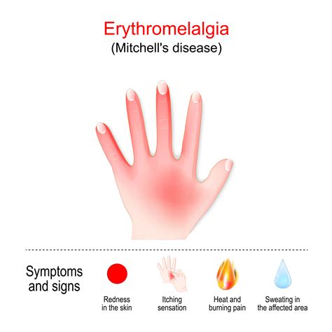 Erythromelalgia Chromocell