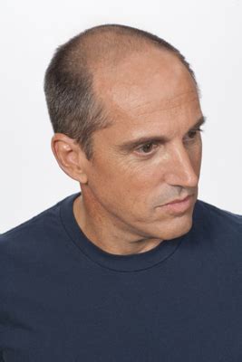 Usually the hair regrows after several months. Wigs for Men - Temecula Wigs - Men's Hair Loss Solutions