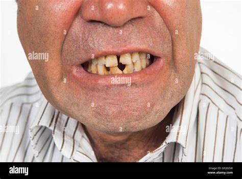 Guy With Bad Teeth Olympiapublishers Com
