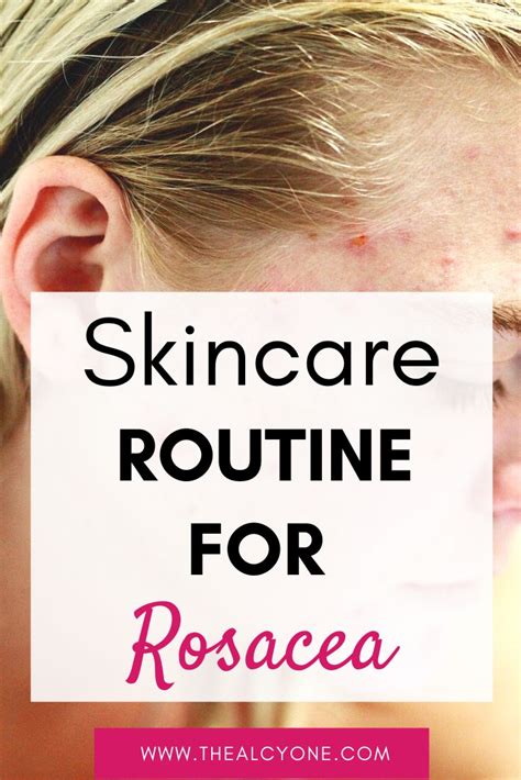 Rosacea Causes Triggers And Skincare Routine For Rosacea Skin Care