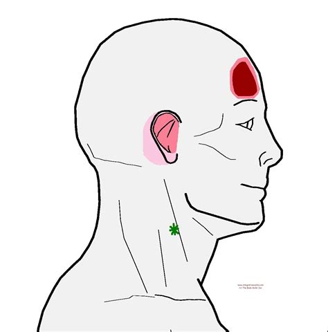 Pin On Headache Trigger Point Pain