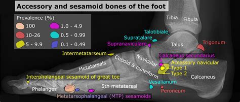 File Accessory And Sesamoid Bones Of The Foot Lateral Projection Physiopedia
