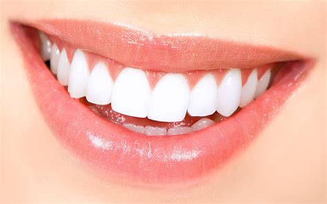 Teeth Whitening Hacks That Are Destroying Your Teeth Daily Active