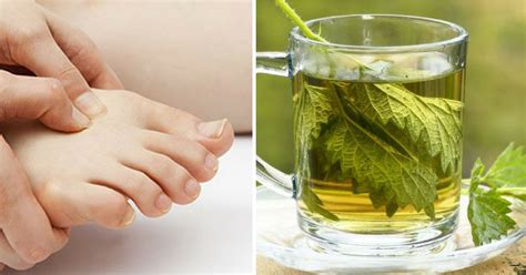 10 Natural Remedies That Can Help Alleviate Your Gout Symptoms