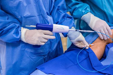 Endovenous Ablation Therapy Vascular And Endovascular