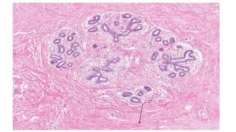 Histology Of The Breast Youtube