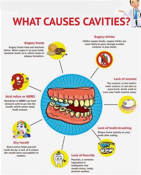 What Causes Tooth Decay Dental Caries Dental Caries Dental