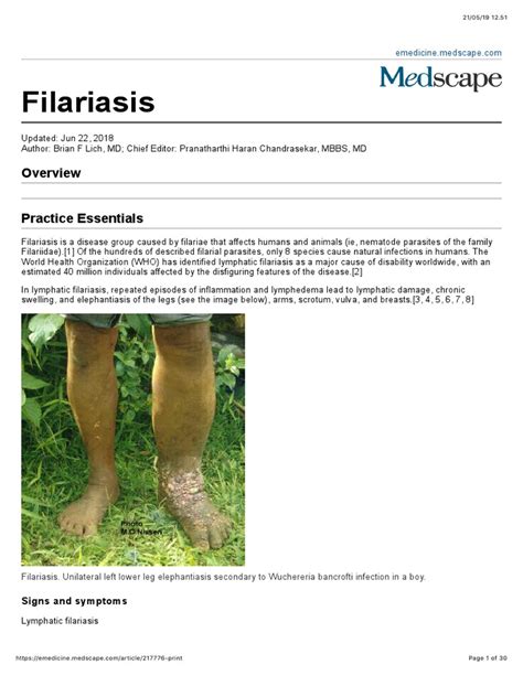 Filariasis Signs And Symptoms Pdf Clinical Medicine Immunology