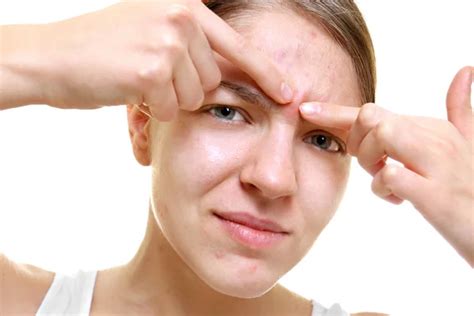 Girl With Pimples Stock Photos Royalty Free Girl With Pimples Images