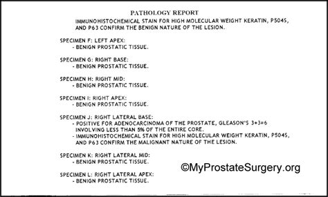 Prostate Biopsy The Suprising Truth About How 2 Biopsies Can Be So Different Prostate Surgery