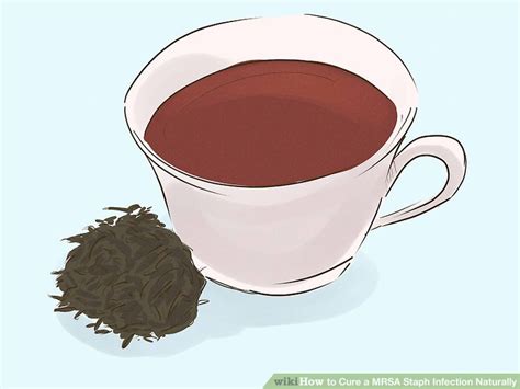 3 Ways To Cure A Mrsa Staph Infection Naturally Wikihow