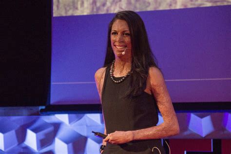 How Turia Pitt Inspired Me To Unmask My Potential