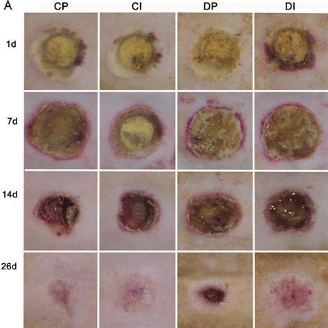 Mages And Analysis Of Wound Area And Reepithelialization The Wound