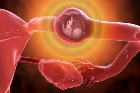 Ectopic Pregnancy An Ectopic Pregnancy Is When A Fertilised Egg