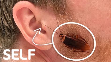 can a cockroach get stuck in your ear how common is it self youtube