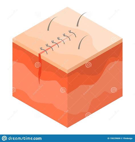 Medical Surgical Suture Icon Isometric Style Stock Vector