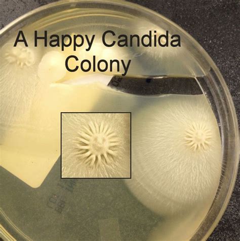 A Happy Candida Colony Medical Laboratory Biomedical Science Biomedical