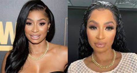 karlie redd new face and plastic surgery before after photos hints its more than lip injections