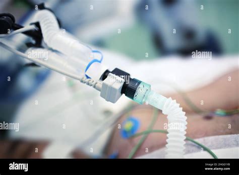 Artificial Lung Ventilation Tube Connected To The Patient In The Bed