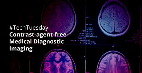 Contrast Agent Free Medical Diagnostic Imaging Worldiscoveries®