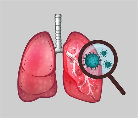 Premium Vector Lungs With Virus
