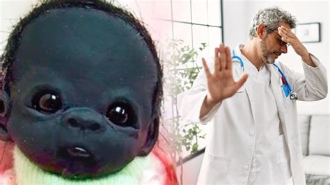 Woman Gives Birth To Strange Looking Baby Doctor Is Shocked When
