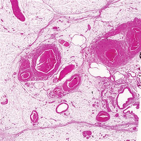 Human Artery And Vein Cs 7 µm Hande Stain Microscope Slide Carolina Biological Supply