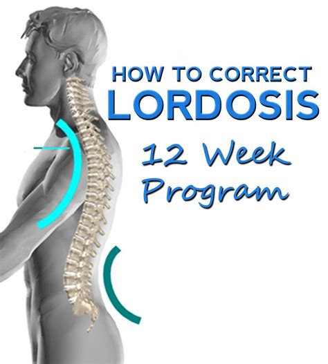 Lordosis How To Correct Lordosis 12 Week Program Psoas Exercises