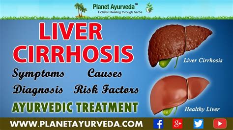 Herbal Remedies For Liver Cirrhosis Treatment Youtube