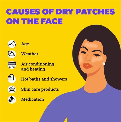 Dry Patches On Face Pictures Causes Remedies Treatment