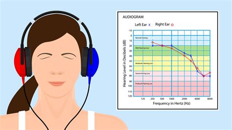What Is An Audiogram And How To Read It Hear Com Reverasite