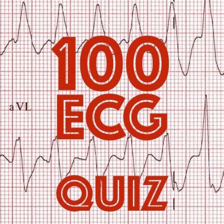 Litfl Ecg Quiz Clinical Cases And Self Assessment To Enhance