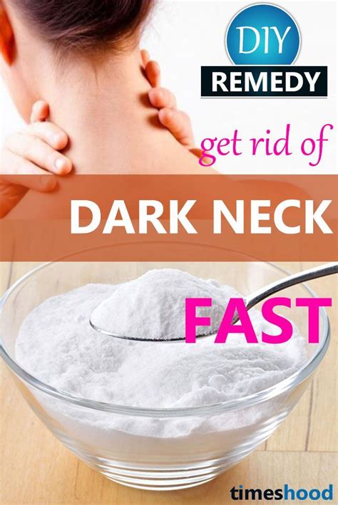 How To Get Rid Of Dark Neck Naturally In 20 Minutes Get Fair Neck With