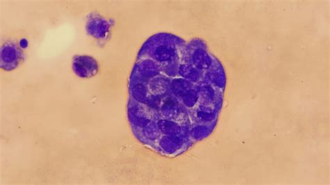 Breast Cancer Explore Microscopy