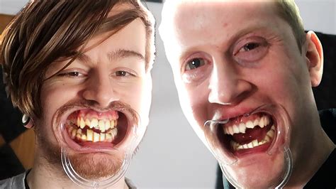 British Stereotypes Teeth