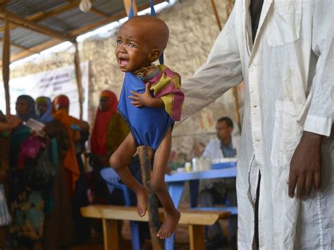 14m Children In Somalia To Suffer Acute Malnutrition In 2017 Unicef