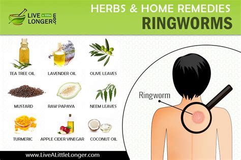 Home Remedies For Ringworms Infographics