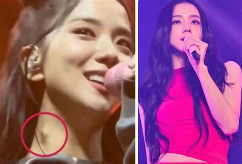 Sbs Star Fans Worry After Spotting A Lump On Blackpink Jisoo S Neck My Xxx Hot Girl