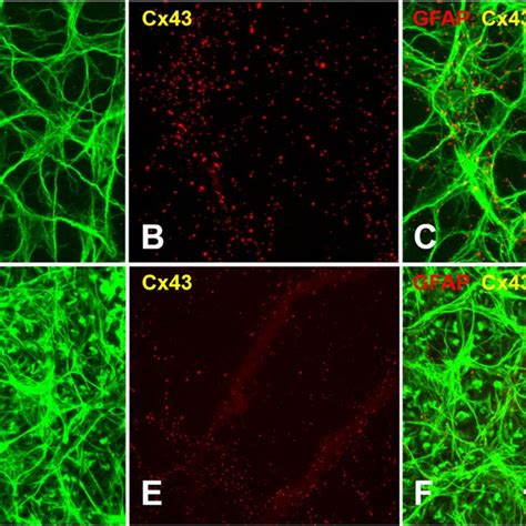 Representative Gfap And Cx43 Staining In Whole Mounted Retinas From An