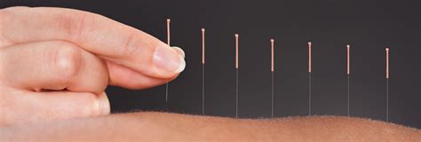 Acupuncture Smart Holistics Holistic Therapies
