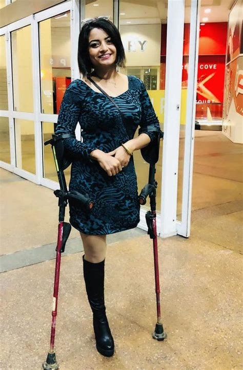 Amputee Woman On Crutches Fashion Women Sweater Dress