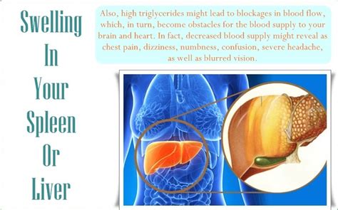 3 Common Signs Of High Triglycerides And Cholesterol