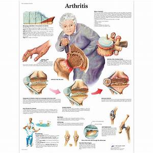 Anatomical Charts And Posters Anatomy Charts Geriatric Health