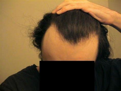 Heres What Your Hairline Says About Your Personality