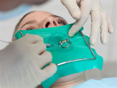 what is a rubber dental dam news dentagama