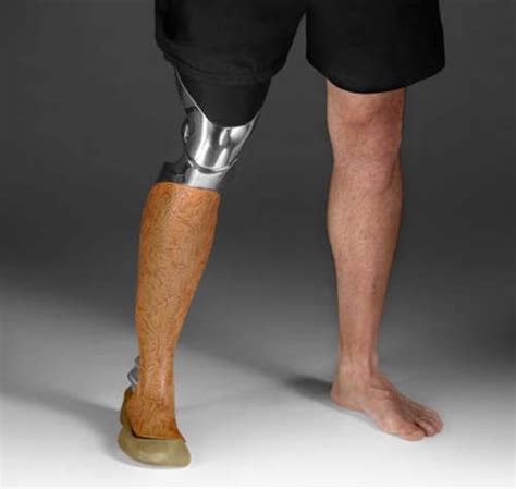 Fashion Focused Prosthetics Prosthetics Prosthetic Leg Amputee
