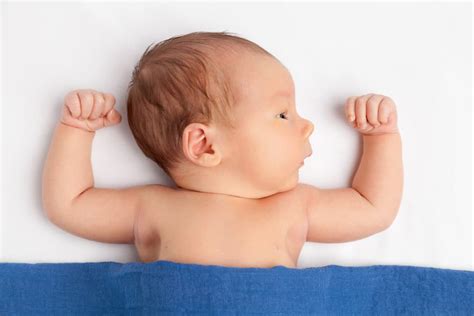 Rickets In Babies Causes Symptoms And Treatment