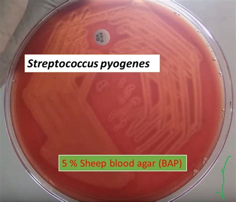 Blood Agar Introduction Composition Preparation Principle And