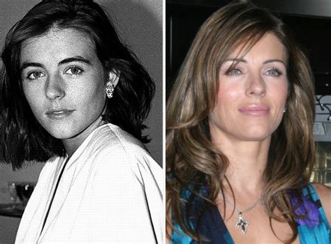 Chatter Busy Elizabeth Hurley Plastic Surgery